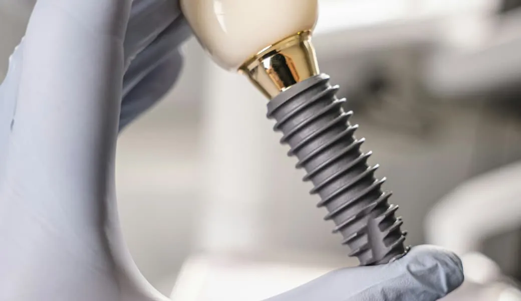 Dłoń w rękawiczce trzyma implant z koroną.